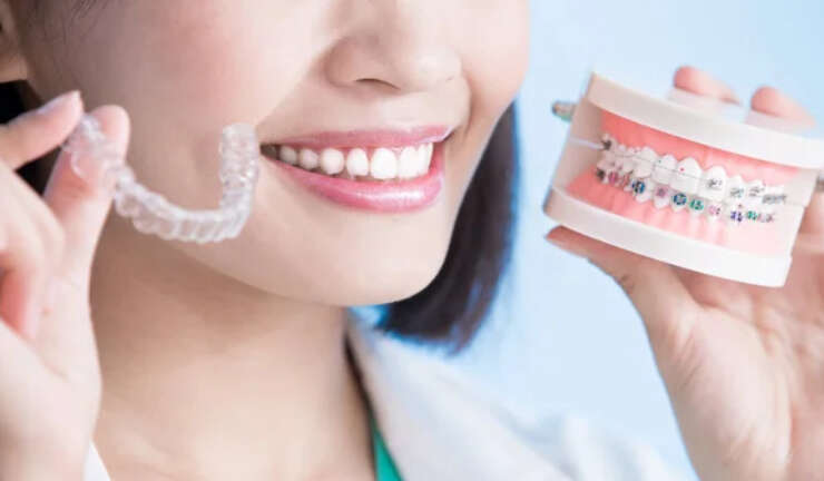 Braces vs Clear Aligners: What’s the Difference?