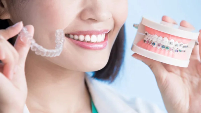 Braces vs Clear Aligners: What’s the Difference?