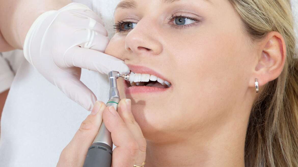 Sealants