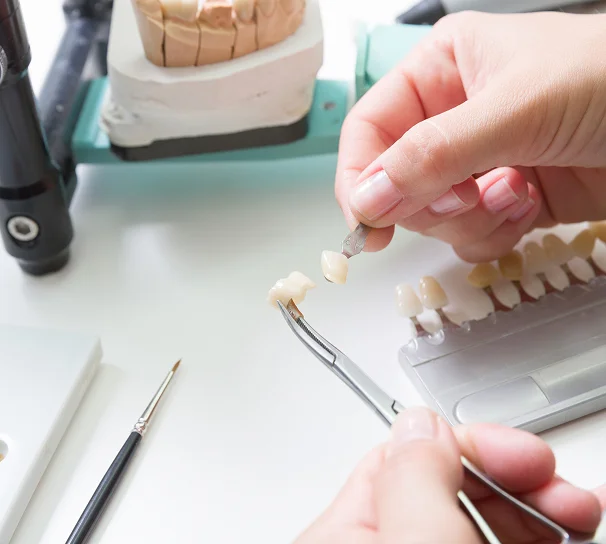 porcelain-veneers_img